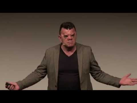 Youtube: Own your face | Robert Hoge | TEDxSouthBank
