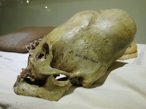 Youtube: The Largest Elongated Skull In The World?