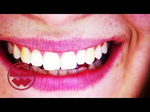 Youtube: Weiße Zähne: Bleaching-Produkte & Co. im Test - Welt der Wunder