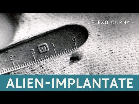 Youtube: Alien-Implantate - Entführt von Außerirdischen? | ExoJournal