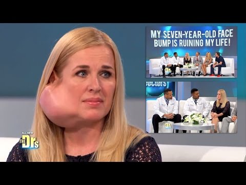 Youtube: Parotidectomy for Large Facial Tumor Removal on The Doctors TV Show