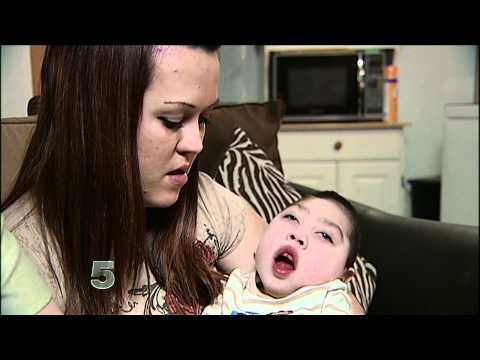 Youtube: Baby born without brain brain turns 2