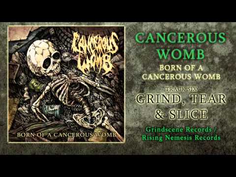 Youtube: Cancerous Womb - Grind, Tear & Slice