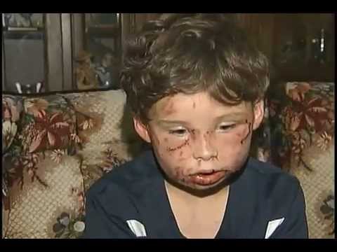 Youtube: Pit Bull Attacks 9 Year Old Boy