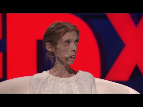 Youtube: Nostalgia | Lene Marie Fossen & Morten Krogvold | TEDxArendal
