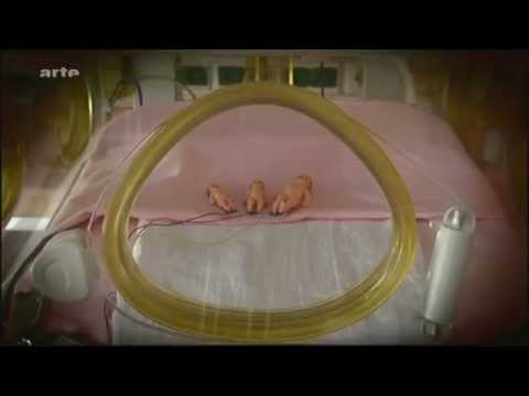 Youtube: [Doku] Die künstliche Gebärmutter - Maschine statt Mama