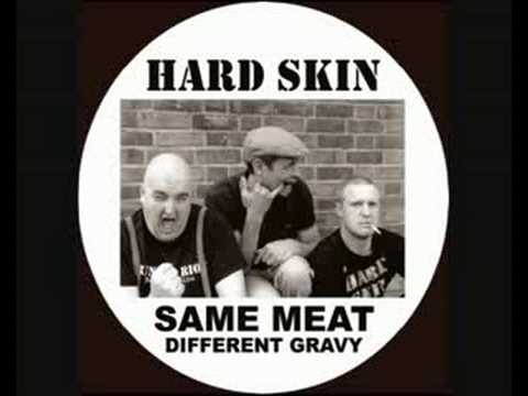 Youtube: Hard Skin - Millwall Mark