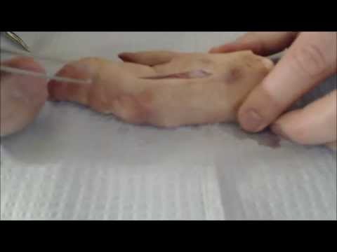 Youtube: Horizontal Mattress Suture Using a Straight Needle for Closing Gaping Wounds
