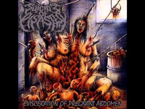 Youtube: Suicide of Disaster - "Dissection Virgin Hole" (2014)