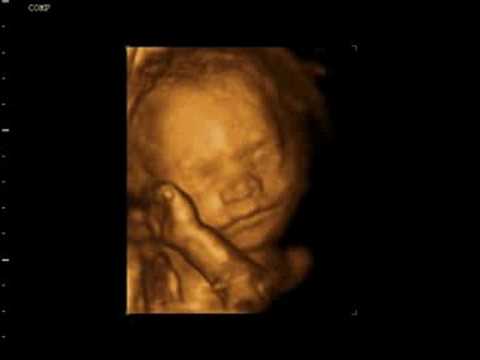 Youtube: Baby 4D Ultraschall Kopf 3D Bauch Kind 28 SSW ultrasound