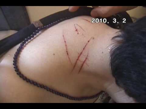 Youtube: 바티칸에서의 성체기적 5, Eucharistic Miracle in the Vatican (2010. 3. 2)