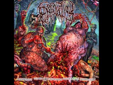 Youtube: Epicardiectomy- Abhorrent Stench of Posthumous Gastrorectal (full album)