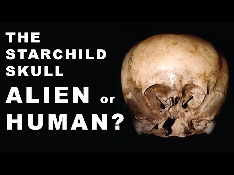 Youtube: the starchild skull - DNA Results - #starchildskull #shortvideo #lloydpye #starchild #aliens