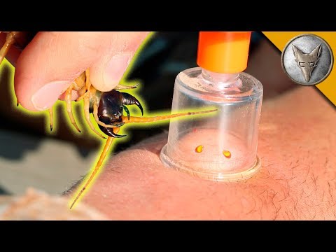 Youtube: VENOM EXTRACTION - Centipede Bite Aftermath!