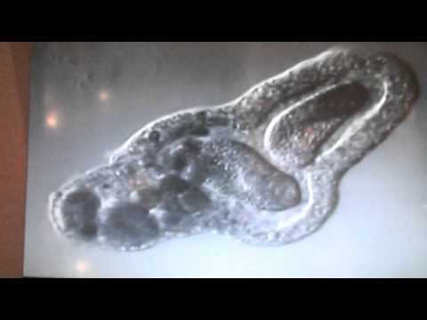 Youtube: Amoeba eats two paramecia (Amoeba's lunch)