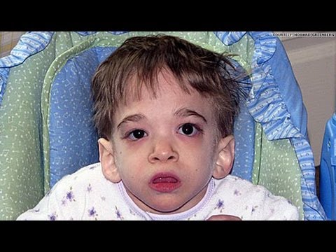 Youtube: 20-year-old woman trapped in child's body