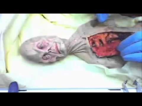 Youtube: shocking video of alien autopsy in Russia in 1969 UFO OVNI. (autpsia a alien en rusia en 1969)