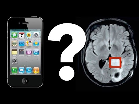 Youtube: Do Cell Phones Cause Brain Tumors?