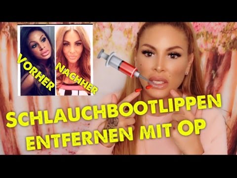 Youtube: Lippen VERKLEINERUNG mit Op | lisha&lou