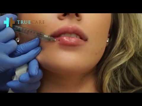 Youtube: BABY BOTTOM LIP INJECTIONS !