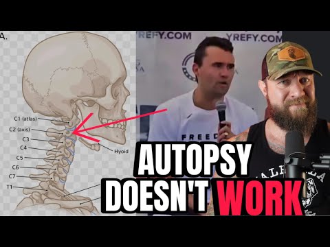 Youtube: New Charlie Kirk "Autopsy" Results DESTROY FBI Narrative of Tyler Robinson as Shooter
