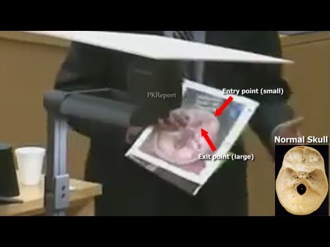 Youtube: Photos of Travis Alexander's Inner Skull Show That Bullet Must Have Hit Frontal Lobe of His Brain
