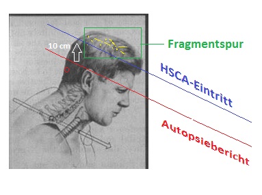 AutopsieEOPcmpHSCA