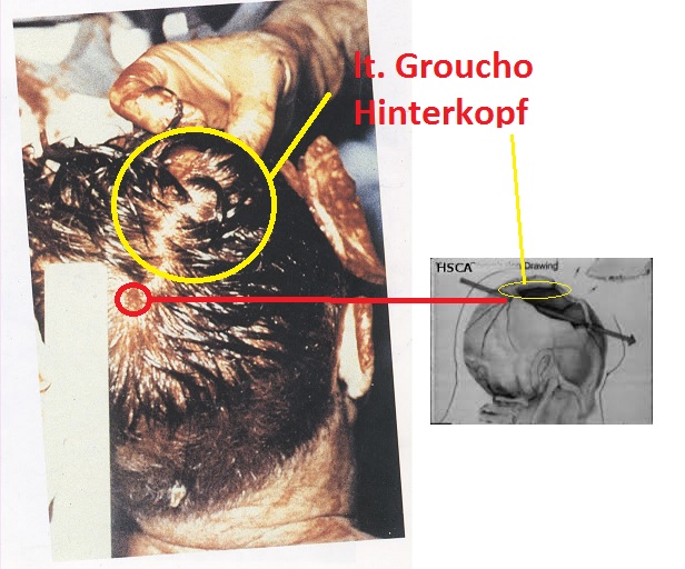 grouchoheadwoundhsca